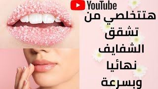 وصفة سريعة للتخلص من تشقق الشفايف في رمضان