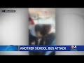 Another school bus beatdown: Mom says special-needs daughter attacked on bus by 2 girls — 1 who doesn't go to the school — on her 15th birthday