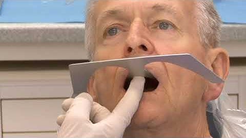 Denture Bootcamp Series Part IV-A: Diagnostic Records I