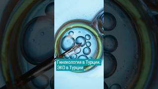 Экстракорпоральное оплодотворение в Турции. ЭКО в Турции. #shorts #медицинавтурции #лечениевтурции