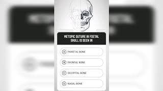 Question #90 | Brain Map Anatomy