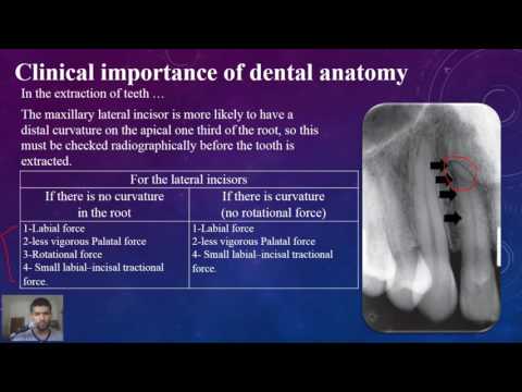 Dental anatomy at a glance, Lec 2, Maxillary lateral incisor Dental anatomy at a glance, Lec 2, Maxillary lateral incisor