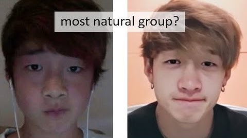 STRAY KIDS PLASTIC SURGERY ANALYSIS