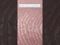 مسامات العرق بالاصابع Sweat Pores 