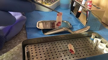 #19  Immediate implant with PRF instructional