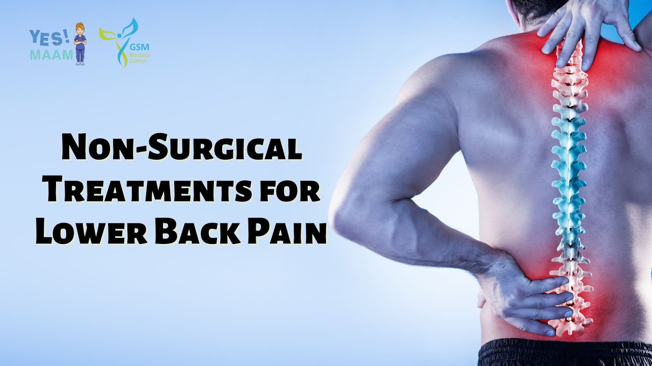 Non-Surgical Treatments for Lower Back Pain - YouTube