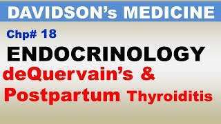 Davidson's Medicine Chp18(Part9) | deQuervain's Thyroiditis | Postpartum Thyroiditis | Endocrinology