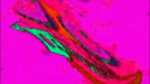 Klasky Csupo Effects (Inspired by RMPE) In Wiggle Major HyperCubed