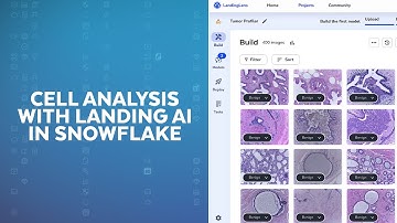 Snowflake and Landing AI Collaborate to Make Complex Medical Diagnoses Easy