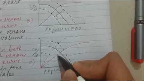 CARDIAC AND VASCULAR function curves for USMLE STEP 1