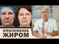 НАНОЛИПОФИЛИНГ VS ЛИПОФИЛИНГ ЛИЦА: ОМОЛОЖЕНИЕ ЖИРОМ 💉🔥 ЧТО ЛУЧШЕ?