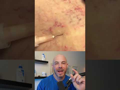 Derm reacts to