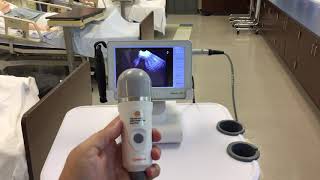 Caresono Bladder Scanner How-To