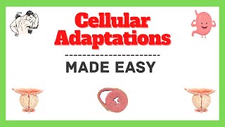 Cellular Adaptation| Cell Adaptation| Hypertrophy| Atrophy| Hyperplasia| Metaplasia| Pathology