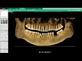 Vatech ez3di  tutoriel   3d pan tab 01  manipuler la 3d  synergy dental
