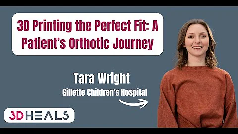 3D Printing the Perfect Fit: A Patient’s Orthotic Journey