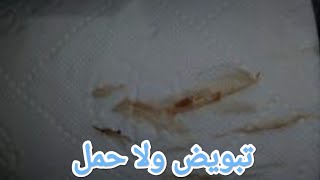 إذا  لاحظت نزول خيوط دم مع افرازات التبويض قبل ميعاد الدوره باسبوع??