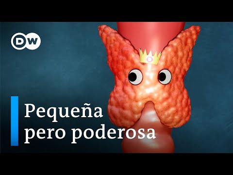 Video: Cómo tratar el hipotiroidismo (con imágenes)