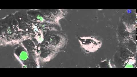 CardiacMyocytes with GFP Cell Division Reporter Gene Tag