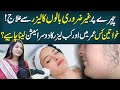 Laser Treatment For Facial Hair Removal In Urdu Dermatologist Health Matters 