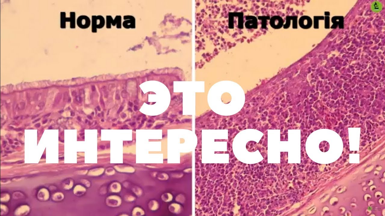 Инфекционный бронхит у кур (ЭТО ИНТЕРЕСНО!) - YouTube