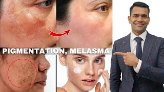 Treat Pigmentation, Melasma and Dark Spot Naturally | Avoid These Mistakes - Dr. Vivek Joshi