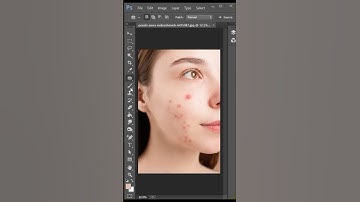 How to remove pimples easily in photoshop 2022 || Onlyfor beginners #shorts #photoshop