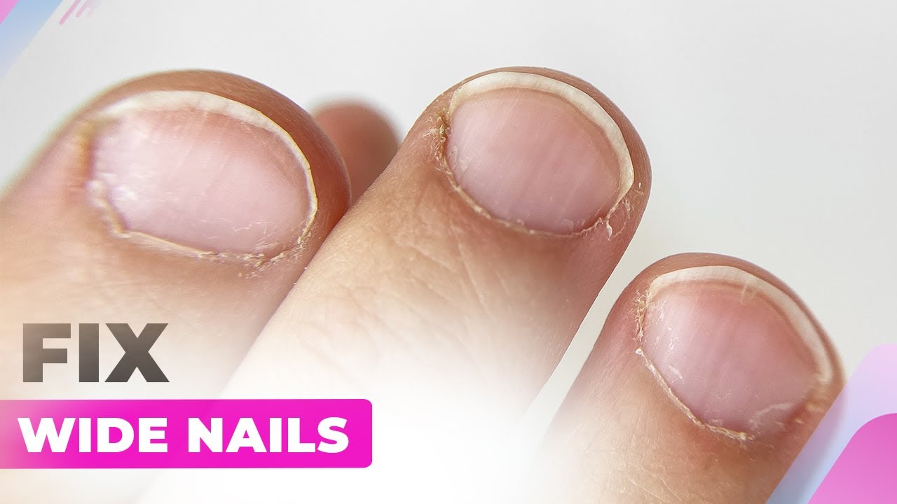 NAIL SHAPE. CAN IT BE CORRECTED? HOW TO TRANSFORM NATURAL NAILS [ANNA'S NAIL  ADVICE] - YouTube