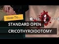 Standard open cricothyroidotomy