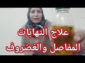 وداعا لألم العظام والمفاصل 2 مكون فقط تجربه خمس سنوات لأ غنا عنه في بيتك