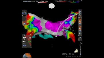High Fidelity Electroanatomic Mapping System