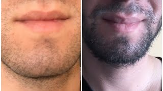 COMO TENER MAS BARBA Y MAS GRUESA - J.M. Montaño