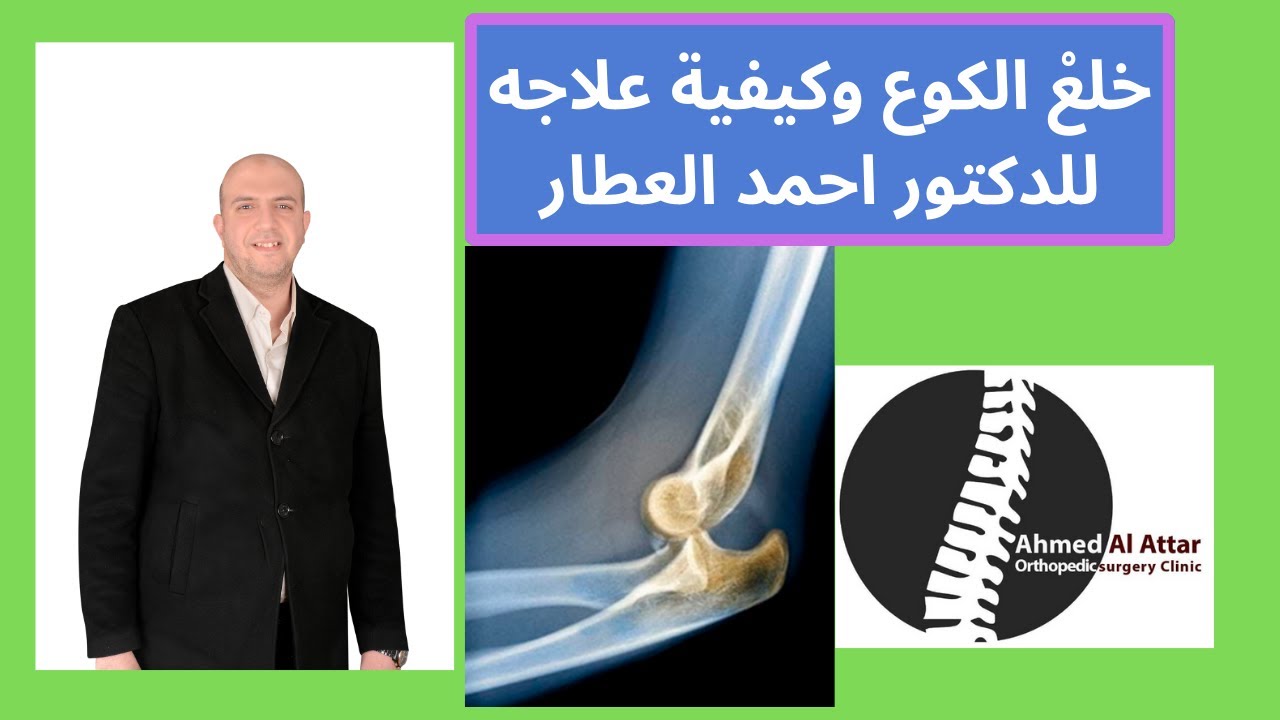 خلعْ الكوع الاسباب والعلاج للدكتور احمد العطار
