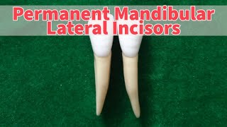 Permanent Mandibular Lateral Incisor