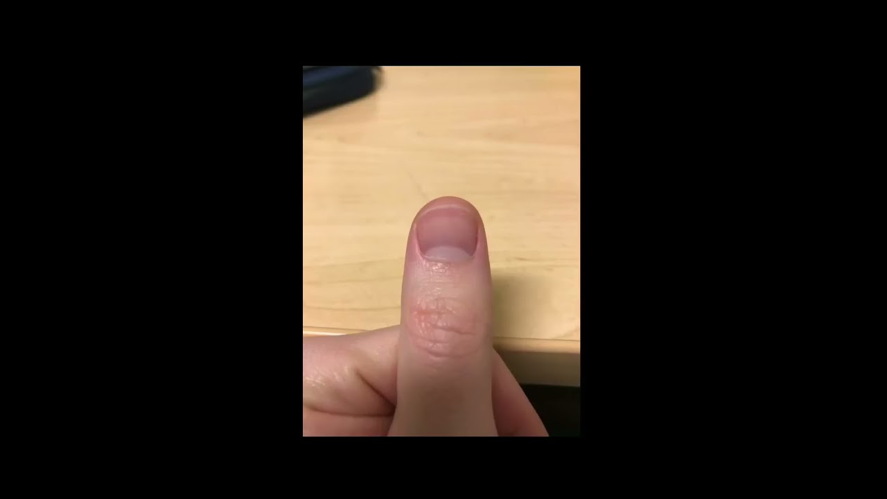Time lapse  Fingernail Growth 4 months