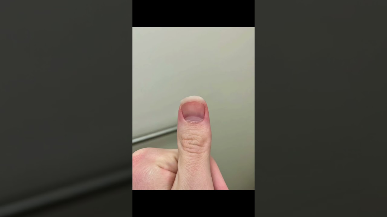 Time Lapse- Fingernail Growth (4 Months)