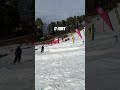 It hurt