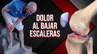 ¿Dolor de rodilla al bajar escaleras? Ejercicios y masaje para solucionarlo