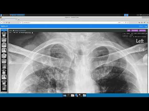 Xilinx Demonstration of an X-ray Classification Solution for COVID-19 and Pneumonia Detection