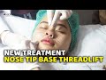 New treatment nose tip base threadlift  novis dermatology