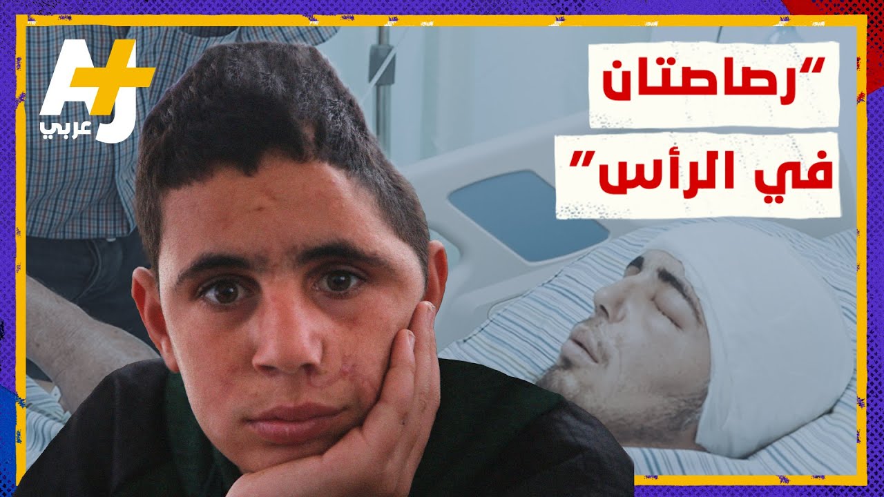 رصاصتان إسرائيليتان في رأس الفلسطيني محمد التميمي بينهما 4 سنوات