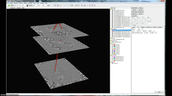 Aortic Pulse Wave Velocity Measurement