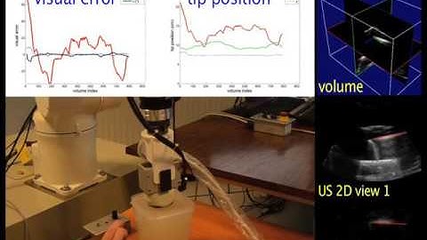 Real-time needle detection and tracking using a visually servoed 3D ultrasound probe