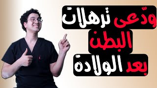 تمارين ترهلات البطن بعد الولادة | أفضل تمارين للبطن في البيت -  Abdominal Exercises