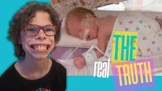 The Truth About Williams Syndrome: Our Rare Reality 🧩 #williamssyndrome #specialneedsparenting