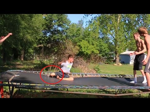 BAD TRAMPOLINE ACCIDENT...