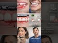 visit ur dentist at least twice a year 🦷✨