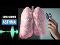 Asthma lung sound  wheezing  asthma  christina np  caring casa