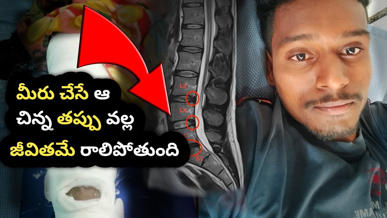🙏 జీవితం ఎప్పుడు ఒకేలా ఉండదు #lifestruggles #backpain #upscaspirants #chronicpain 
