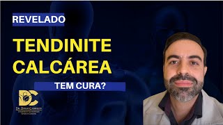 Calcificação do tendão: COMO eu trato a tendinite Calcárea do ombro